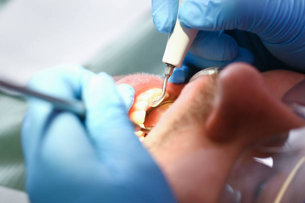 Best Dental Abscess Treatment in Oxford, KS